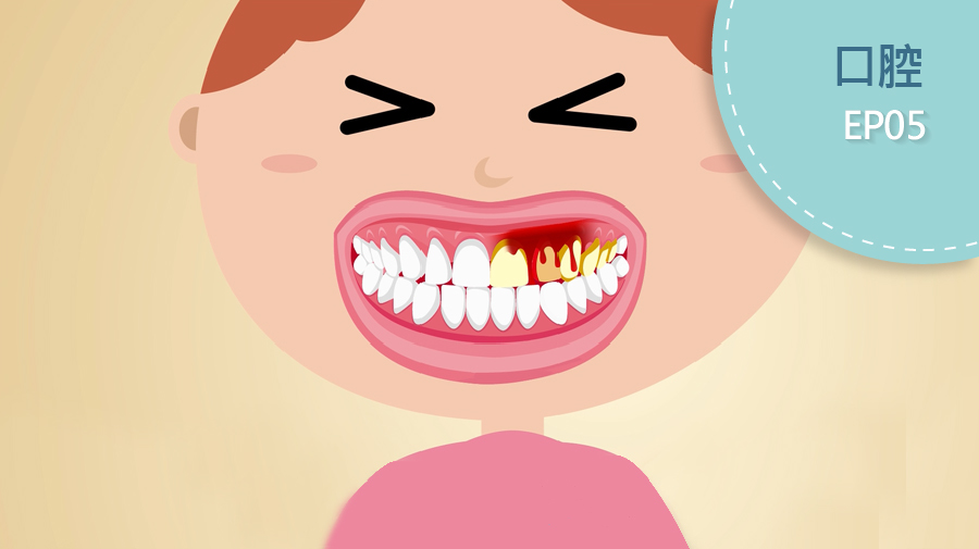 牙周病九大症狀和自我檢測三步驟（郭羽芳 醫師）